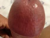 Pinkhead